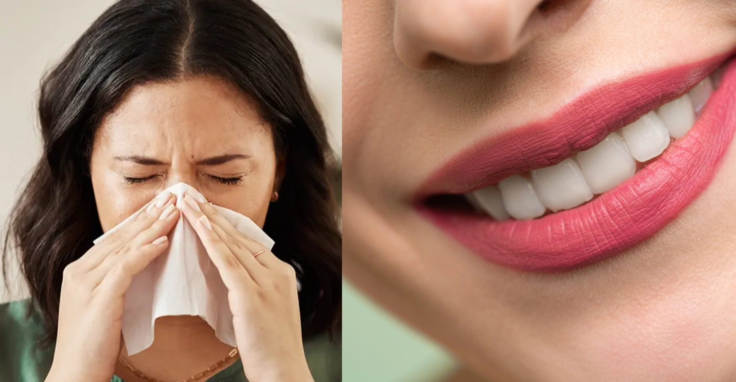 H5N1 Bird flu and oral health 2
